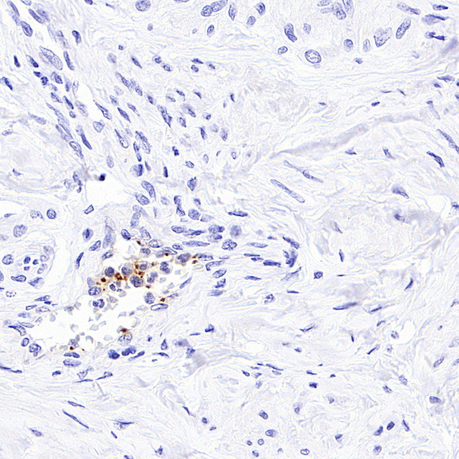 PF4 Recombinant Rabbit mAb (SDT-4218)