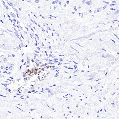 PF4 Recombinant Rabbit mAb (SDT-4218)