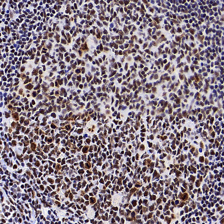 NPM1 Recombinant Rabbit mAb (S-4119-58)