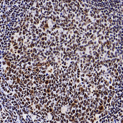 NPM1 Recombinant Rabbit mAb (S-4119-58)