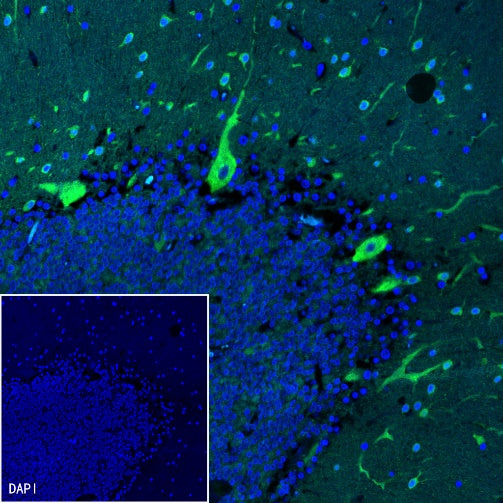 PSD-95 Recombinant Rabbit mAb (S-1518-4)