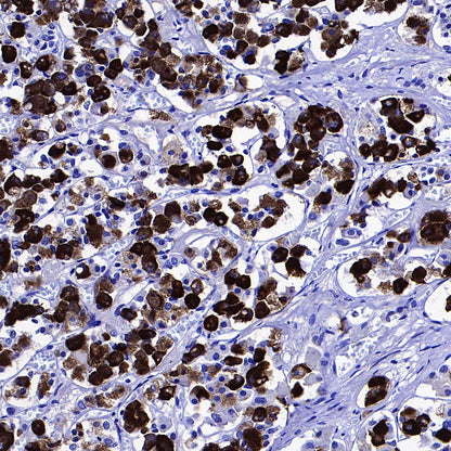 NPTX2 Recombinant Rabbit mAb (S-4048-54)
