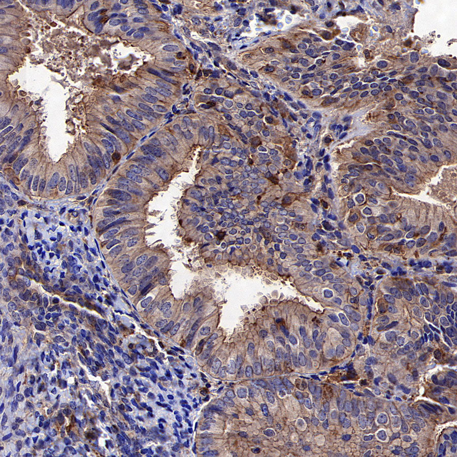 Beta Actin Recombinant Mouse mAb (S-5033)