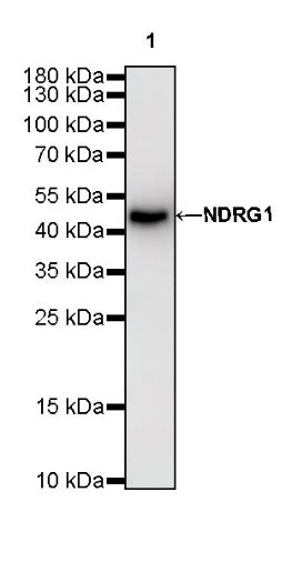 NDRG1 Recombinant Rabbit mAb (S-623-82)