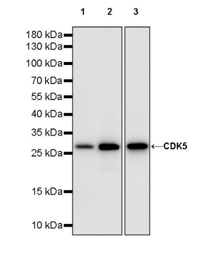 CDK5 Recombinant Rabbit mAb (S-1309-115)