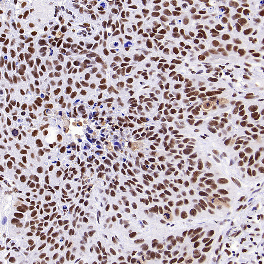 CDK11/CDC2L2/CDK11A Recombinant Rabbit mAb (S-3994-75)