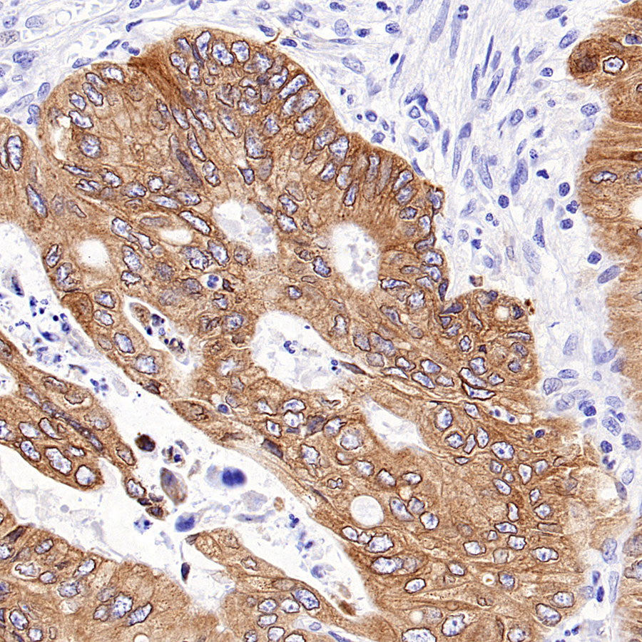 CDS1 Recombinant Rabbit mAb (S-3671-30)
