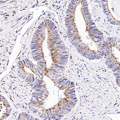 Niemann Pick C1 Recombinant Rabbit mAb (S-5243)