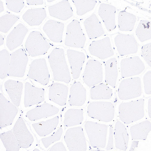 NPHS2 Recombinant Rabbit mAb (S-1824-36)