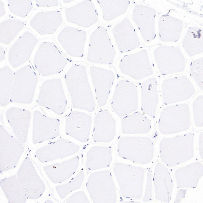 NPHS2 Recombinant Rabbit mAb (S-1824-36)