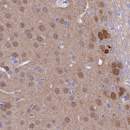 JNK1 Recombinant Rabbit mAb (S-1153-21)