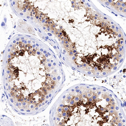 Aquaporin 5/AQP5 Recombinant Rabbit mAb (S-1622-5)