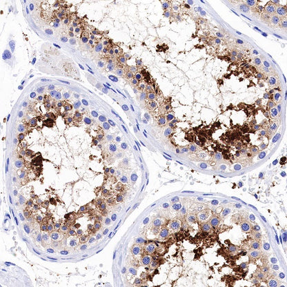 Aquaporin 5/AQP5 Recombinant Rabbit mAb (S-1622-5)