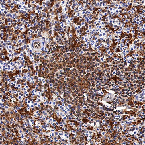 Peroxiredoxin 1/PAG Recombinant Rabbit mAb (S-1673-22)
