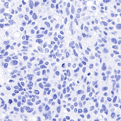 Myelin Basic Protein Recombinant Rabbit mAb (S-582-79)