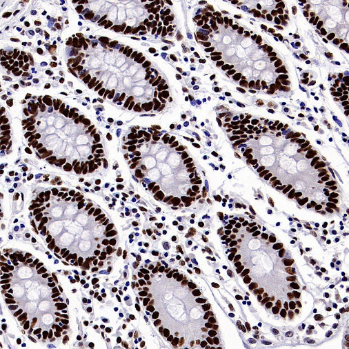 SP1 Recombinant Rabbit mAb (S-3073-71)