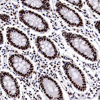 SP1 Recombinant Rabbit mAb (S-3073-71)