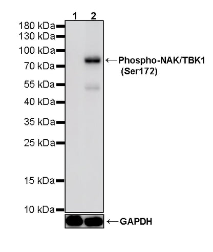 Phospho-TBK1/NAK (Ser172) Recombinant Rabbit mAb (S-5532)