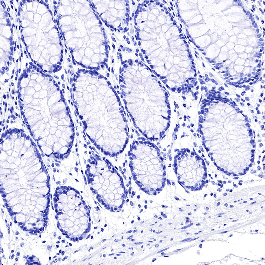 CGA/HCG-α Recombinant Rabbit mAb (SDT-227-66)