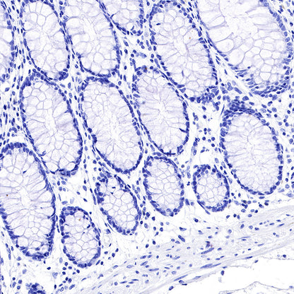 CGA/HCG-α Recombinant Rabbit mAb (SDT-227-66)