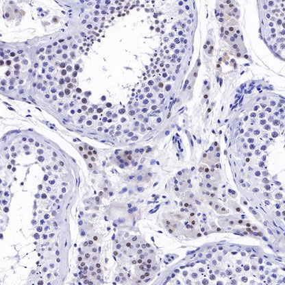 Nucleophosmin/NPM Recombinant Rabbit mAb (S-R231)