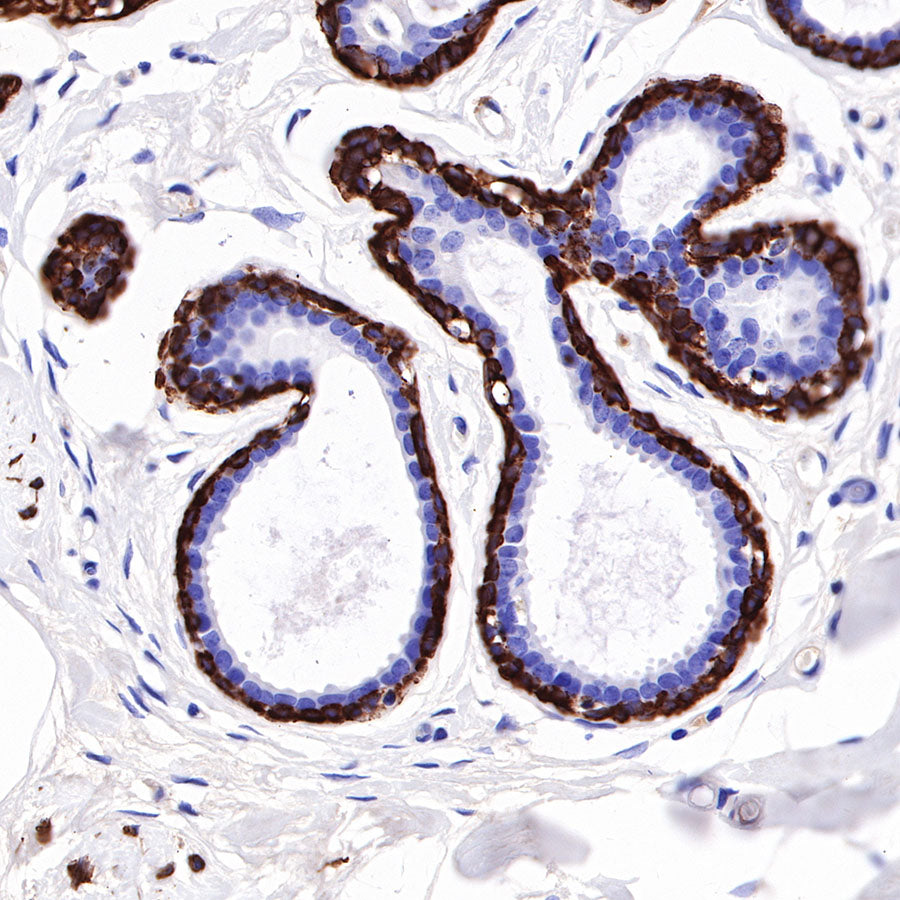Myosin-11/SMMHC Recombinant Rabbit mAb,PBS Only (SDT-188-112)