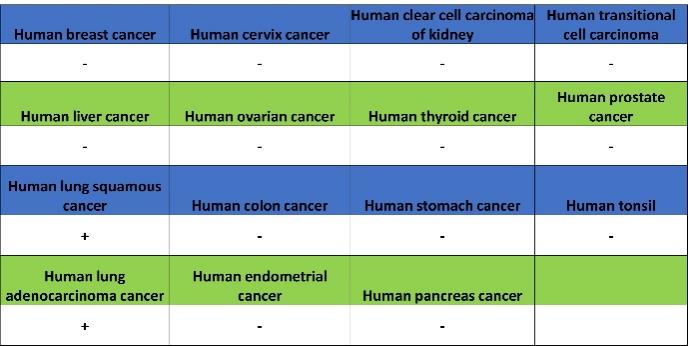 AQP4 Recombinant Rabbit mAb (S-1609-62)
