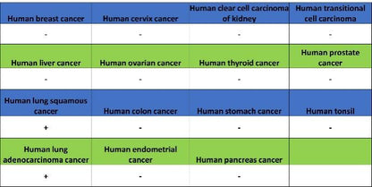AQP4 Recombinant Rabbit mAb (S-1609-62)
