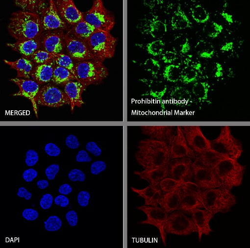 Prohibitin Recombinant Rabbit mAb (S-2679-7)