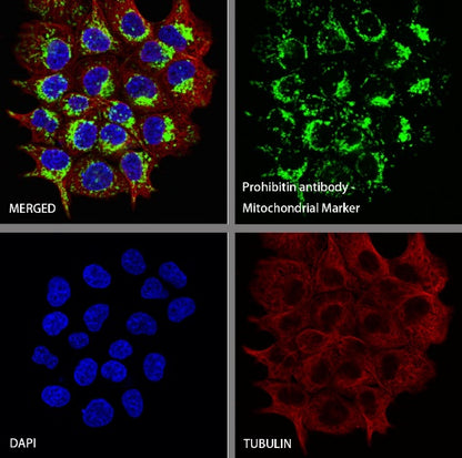 Prohibitin Recombinant Rabbit mAb (S-2679-7)