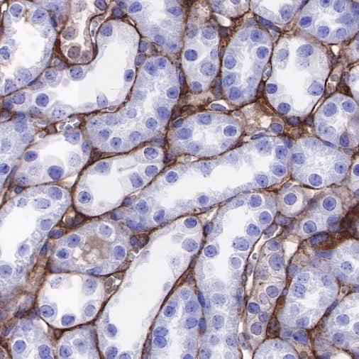 Lumican Recombinant Rabbit mAb (S-247-47)