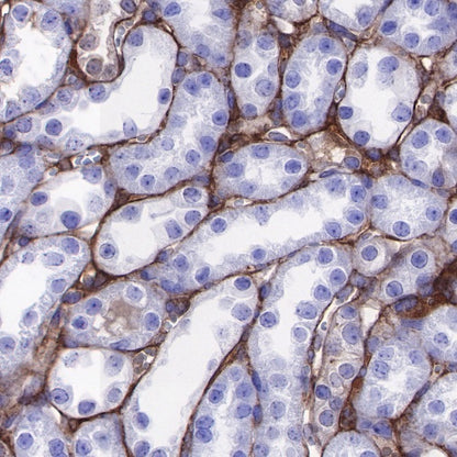 Lumican Recombinant Rabbit mAb (S-247-47)