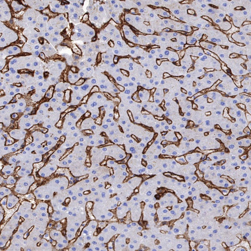S-RMab®Annexin A2 Recombinant Rabbit mAb (SDT-444-67)