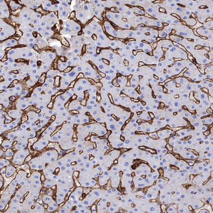 S-RMab®Annexin A2 Recombinant Rabbit mAb (SDT-444-67)