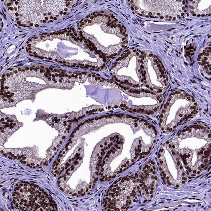 U2AF1 Recombinant Rabbit mAb (S-2384)