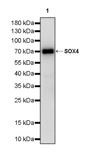 SOX4 Recombinant Rabbit mAb (S-2207-103)