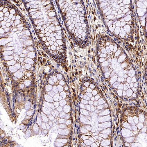 GORASP2 Recombinant Rabbit mAb (S-2526-47)