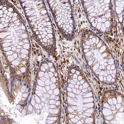 GORASP2 Recombinant Rabbit mAb (S-2526-47)