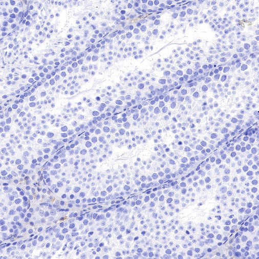 α-Synuclein Recombinant Rabbit mAb (S-441-86)