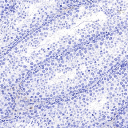 α-Synuclein Recombinant Rabbit mAb (S-441-86)