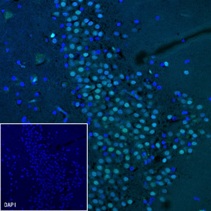HuD/ELAVL4 Recombinant Rabbit mAb (S-1351-159)