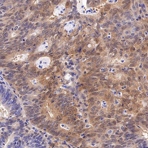 Caspase-7 Recombinant Rabbit mAb (S-R254)