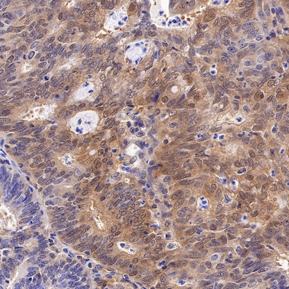 Caspase-7 Recombinant Rabbit mAb (S-R254)