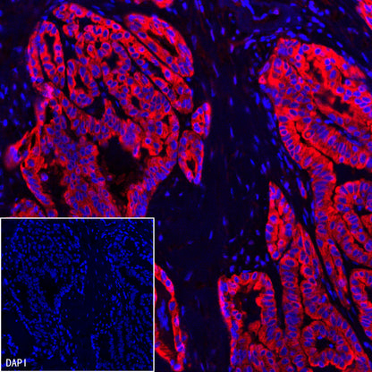 RRM1 Recombinant Rabbit mAb (SDT-R152)