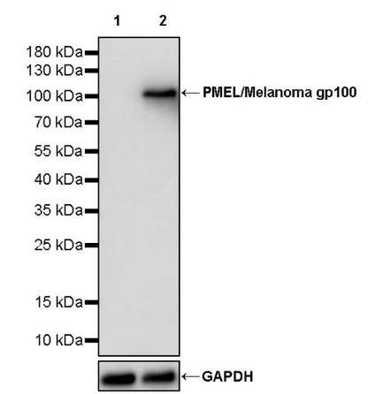PMEL/Melanoma gp100 Recombinant Rabbit mAb (SDT-3393)