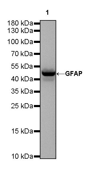 GFAP Recombinant Rabbit mAb (SDT-306-10)