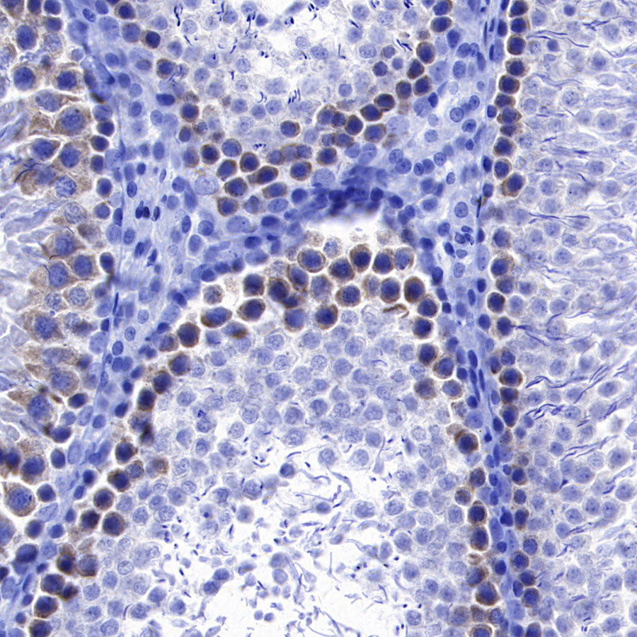 YTHDC2 Recombinant Rabbit mAb (S-3338-41)