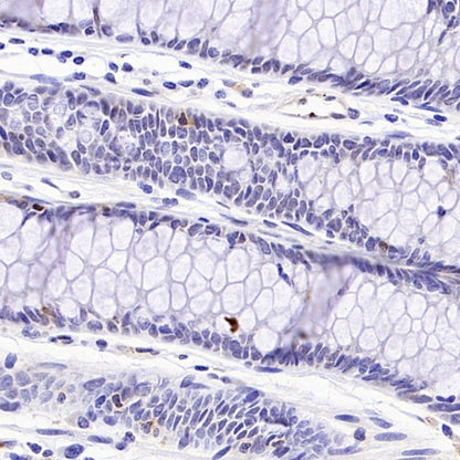 CDKN2A/p16 INK4A Recombinant Rabbit mAb (S-4676)