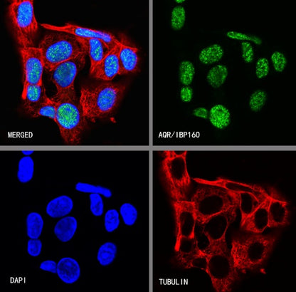 AQR/IBP160 Recombinant Rabbit mAb (S-1329-248)