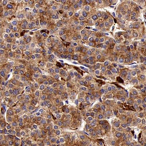 beta Galactosidase/GLB1 Recombinant Rabbit mAb (S-2295-7)